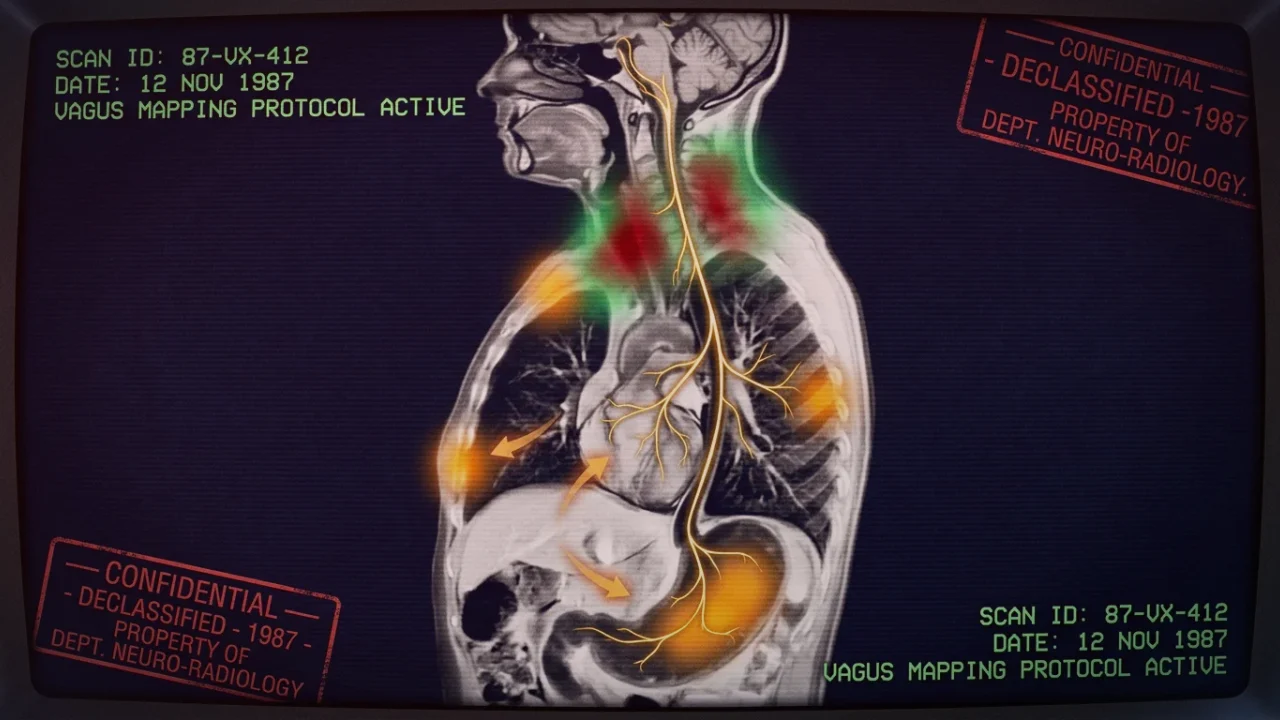 Medical anatomical illustration comparing distal esophageal spasm and hypercontractile Nutcracker esophagus manometry with cardiac ischemia pathways
